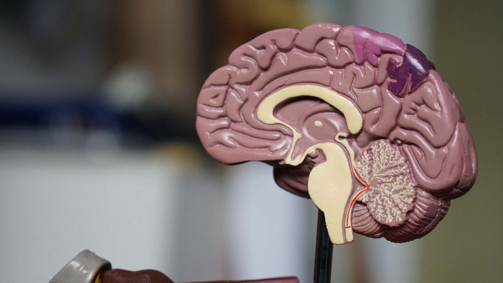 Eli Lilly’s Alzhiemer’s Drug Shows Potential in Final Trials