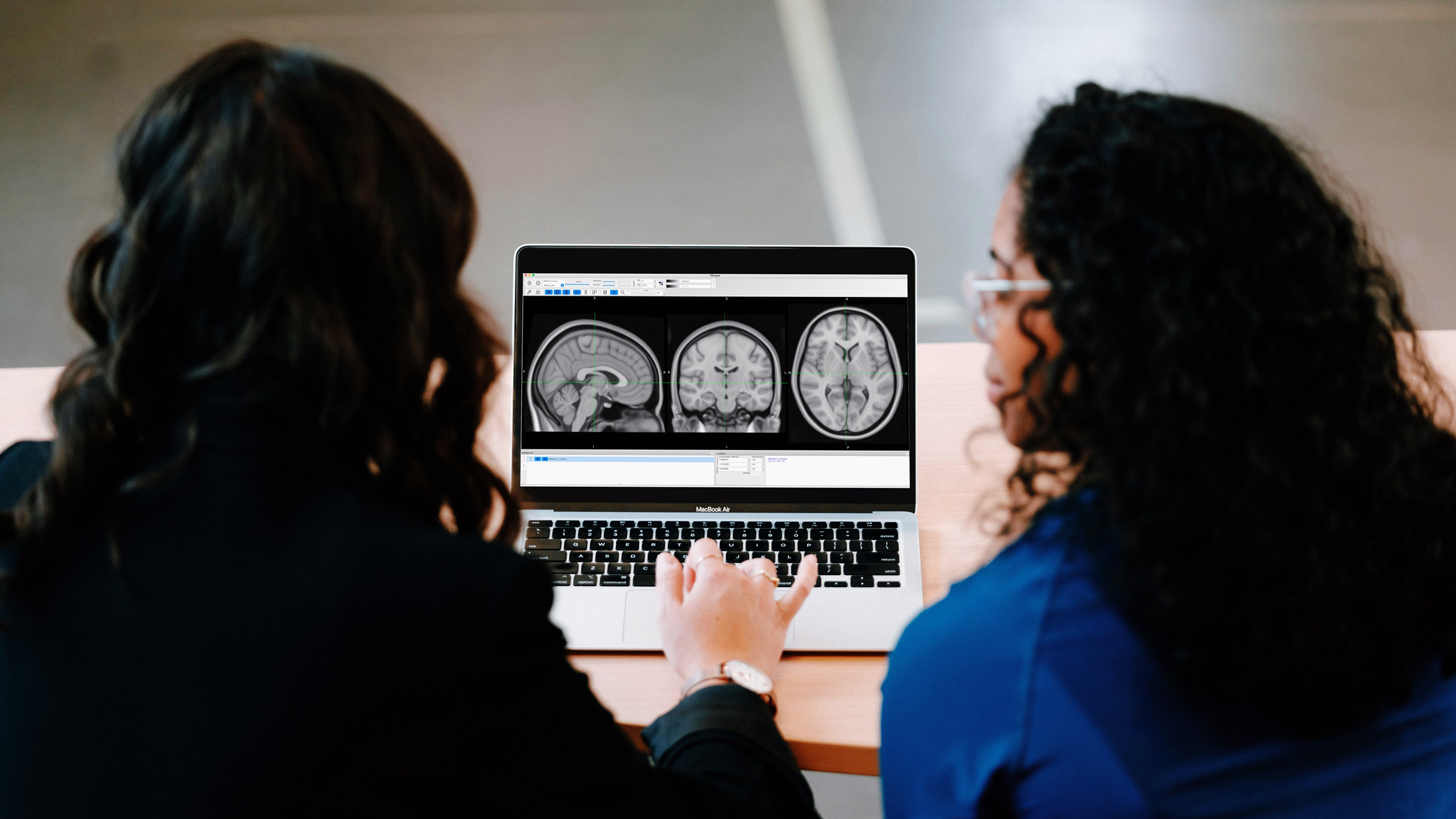 Photo of a brain diagram on a computer